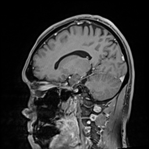 Click on the Serie image to view the images of VILLANUEVA, WILLIAM A.